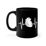 Mug Heart with Pulse Mug - Physio Memes